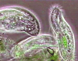 Image Of Phylum Protozoa.